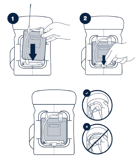 How to set up the Beltpack Module?